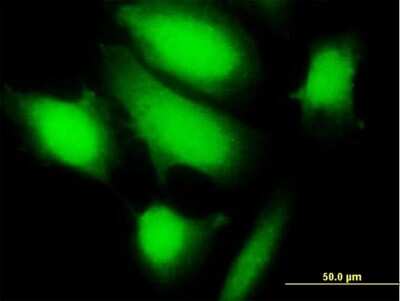 Immunocytochemistry/ Immunofluorescence: KCTD17 Antibody [H00079734-B01P]