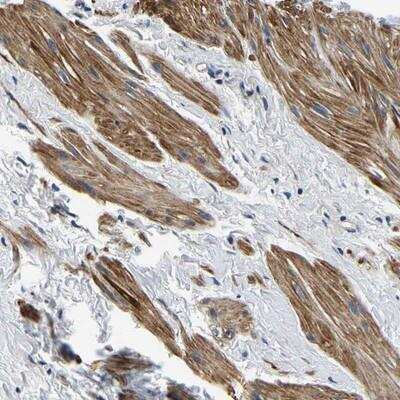 Immunohistochemistry-Paraffin: KCTD17 Antibody [NBP1-82306]