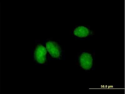 Immunocytochemistry/ Immunofluorescence: KCTD18 Antibody [H00130535-B01P]