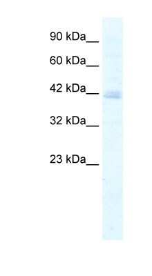 Western Blot: KCTD18 Antibody [NBP1-80093]