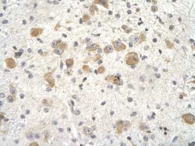 Immunohistochemistry: KCTD3 Antibody [NBP1-80074]