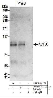 Immunoprecipitation: KCTD3 Antibody [NBP2-44277]