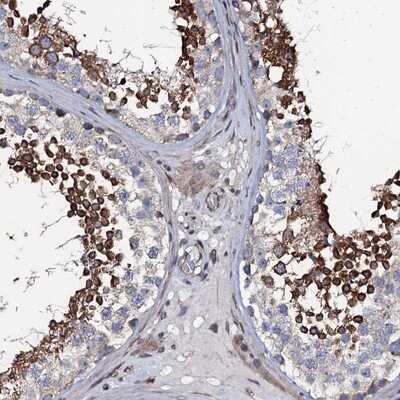 Immunohistochemistry-Paraffin: KCTD4 Antibody [NBP1-92045]