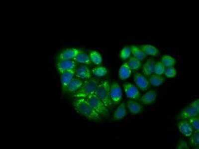 Immunocytochemistry/ Immunofluorescence: KCTD5 Antibody (OTI3C8) - Azide and BSA Free [NBP2-71955]