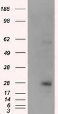 Western Blot: KCTD5 Antibody (OTI3C8)Azide and BSA Free [NBP2-71955]
