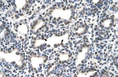 Immunohistochemistry-Paraffin: KCTD6 Antibody [NBP1-80095]