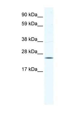 Western Blot: KCTD6 Antibody [NBP1-80273]