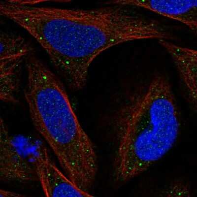 Immunocytochemistry/ Immunofluorescence: KCTD8 Antibody [NBP1-86327]