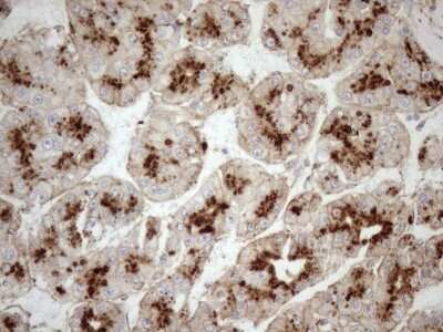 Immunohistochemistry: KCTD9 Antibody (OTI2G8) [NBP2-45488]