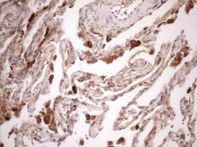 Immunohistochemistry: KCTD9 Antibody (OTI2G8) [NBP2-45488]