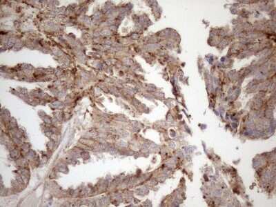 Immunohistochemistry: KCTD9 Antibody (OTI2G8) [NBP2-45488]
