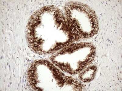 Immunohistochemistry: KCTD9 Antibody (OTI2G8) [NBP2-45488]