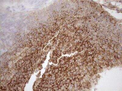 Immunohistochemistry: KCTD9 Antibody (OTI2G8) [NBP2-45488]