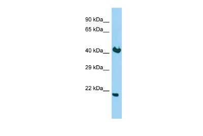 Western Blot: KDELR2 Antibody [NBP2-85140]