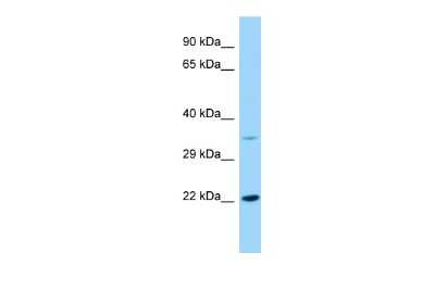 Western Blot: KDELR2 Antibody [NBP2-85141]