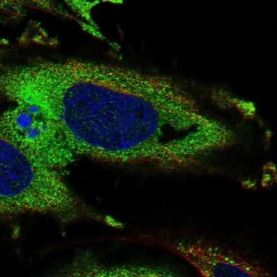 Immunocytochemistry/ Immunofluorescence: KDELR3 Antibody [NBP2-57455]