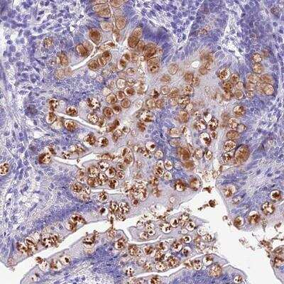 Immunohistochemistry-Paraffin: KDELR3 Antibody [NBP1-92048]