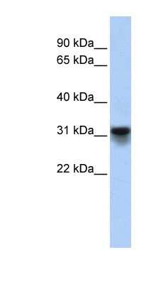 Western Blot: KDELR3 Antibody [NBP1-62653]