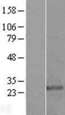 Western Blot: KDELR3 Overexpression Lysate [NBL1-12222]