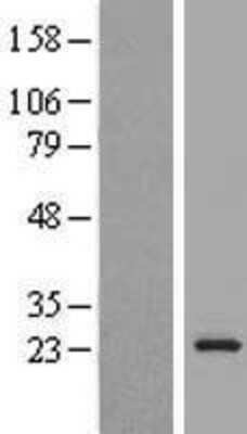 Western Blot: KDELR3 Overexpression Lysate [NBP2-07005]