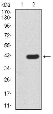 Western Blot: KDM2B Antibody (6F6G11)BSA Free [NBP2-52467]