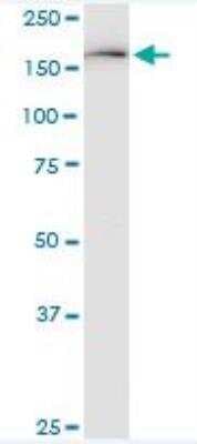 Western Blot: KDM6A Antibody (4E7) [H00007403-M05]