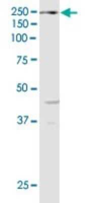 Western Blot: KDM6A Antibody (4E7) [H00007403-M05]