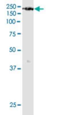Western Blot: KDM6A Antibody (4E7) [H00007403-M05]