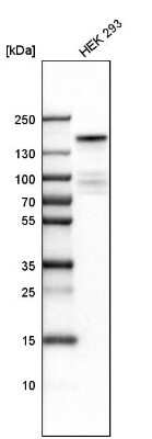 Western Blot: KDM6A Antibody [NBP1-80628]