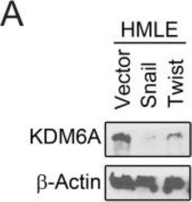 Western Blot: KDM6A Antibody [NBP1-80628]