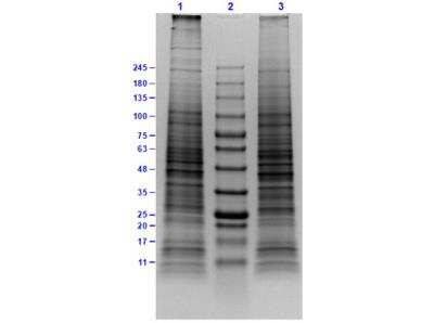 SDS-PAGE: KG-1 Whole Cell Lysate [NBP3-05284]