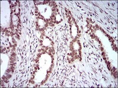 Immunohistochemistry: KHDRBS2 Antibody (7G8C10) - BSA Free [NBP2-37254]