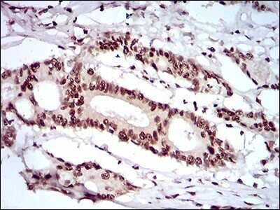Immunohistochemistry: KHDRBS2 Antibody (7G8C10) - BSA Free [NBP2-37254]