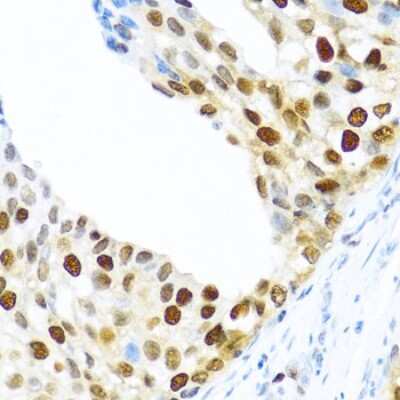 Immunohistochemistry-Paraffin: KHDRBS2 Antibody - BSA Free [NBP3-03933]