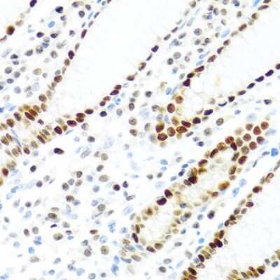 Immunohistochemistry-Paraffin: KHDRBS2 Antibody - BSA Free [NBP3-03933]