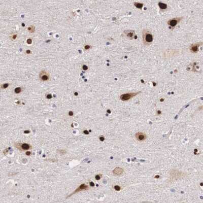 Immunohistochemistry-Paraffin: KHDRBS3 Antibody [NBP1-84773]