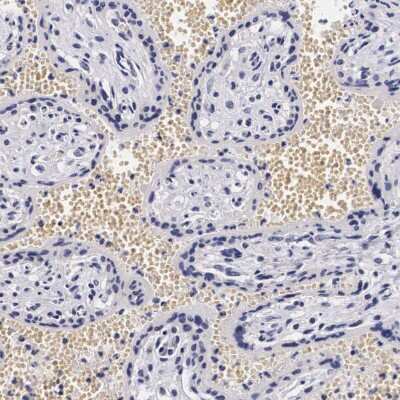 Immunohistochemistry-Paraffin: KHDRBS3 Antibody [NBP1-84773]