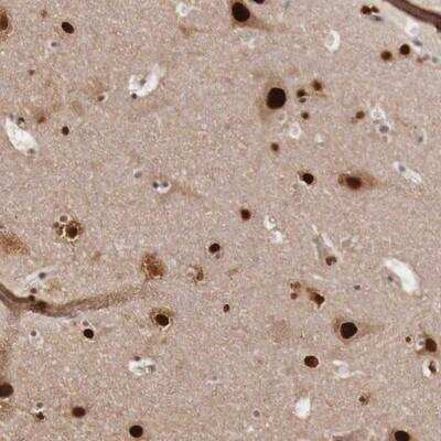 Immunohistochemistry-Paraffin: KHDRBS3 Antibody [NBP1-84774]
