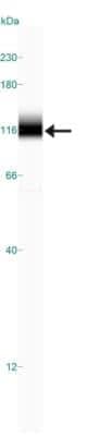 Simple Western: KHSRP Antibody [NBP1-18910]