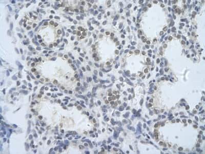 Immunohistochemistry: PUM3 Antibody [NBP1-57531]
