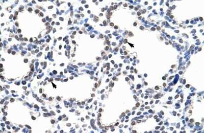 Immunohistochemistry-Paraffin: PUM3 Antibody [NBP1-57531]