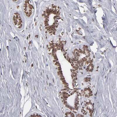 Immunohistochemistry-Paraffin: PUM3 Antibody [NBP1-87296]