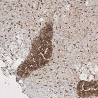 Immunohistochemistry-Paraffin: PUM3 Antibody [NBP1-87296]