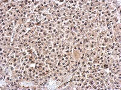Immunohistochemistry-Paraffin: PUM3 Antibody [NBP2-17042]