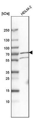 Western Blot: PUM3 Antibody [NBP1-87296]