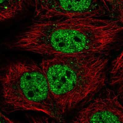 Immunocytochemistry/ Immunofluorescence: KIAA0040 Antibody [NBP2-49573]