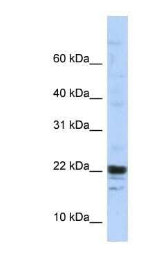 Western Blot: KIAA0040 Antibody [NBP1-91623]