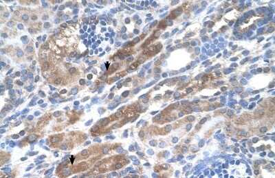 Immunohistochemistry-Paraffin: KIAA0319 Antibody [NBP1-59471]