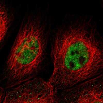 Immunocytochemistry/ Immunofluorescence: KIAA0355 Antibody [NBP1-90943]
