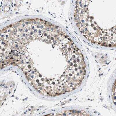 Immunohistochemistry-Paraffin: KIAA0355 Antibody [NBP1-90943]